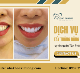 Dịch vụ tẩy trắng răng thẩm mỹ tại nha khoa uy tín quận Tân Phú hiện nay
