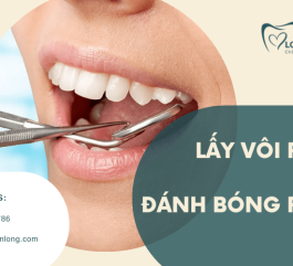 Lấy vôi răng và đánh bóng tại Tân Phú - Trả lại nụ cười trắng sáng tự nhiên