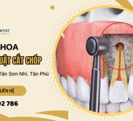Nha khoa phẫu thuật cắt chóp an toàn và chính xác tại Tân Sơn Nhì, Tân Phú