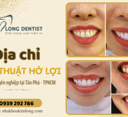 Phẫu thuật cười hở lợi ở đâu tốt nhất hiện nay tại Tân Phú, TPHCM?